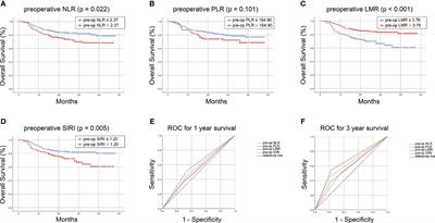 Nomogram incorporating potent inflammatory indicators for overall survival estimation of patients with primary oral squamous cell carcinoma